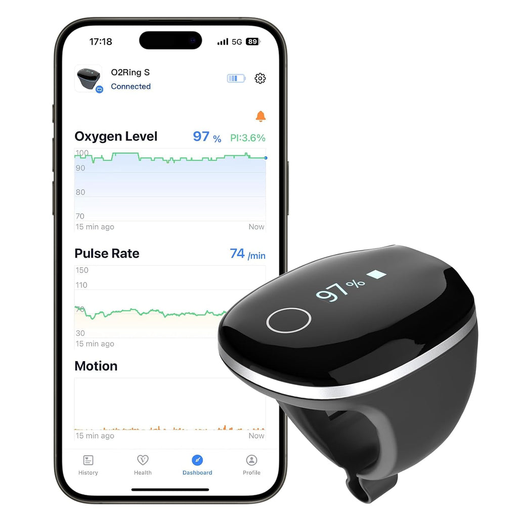 Wellue O2Ring-S Oxygen Monitor with Vibration Reminder, Bluetooth Pulse Oximeter Tracks SPO2 and Pulse Rate, 24 hrs Battery Life, 4*10 Hours Built-in Memory, Rechargeable Pulse Ox with Free PC & APP
