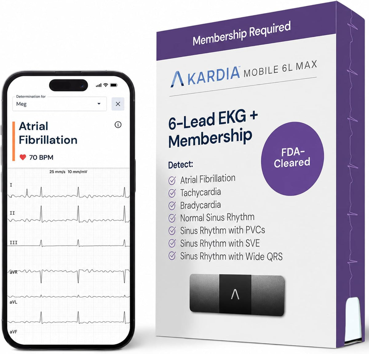KardiaMobile 6L Max 6-Lead EKG + One-Year Membership, Unlimited Recordings